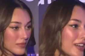dilan-cicek-deniz-estetiklerini-eritti-cYjjwmqW.webp
