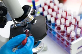 hivi-ayirmak-icin-crispr-teknolojisi-kullanildi-yZkqx2wl.jpg