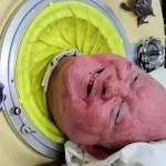 metal-bir-kapsul-icinde-72-yilini-geciren-ve-polio-paul-olarak-taninan-paul-alexander-imhZQi35.jpg